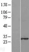SIAH Interacting Protein (CACYBP) (NM 014412) Human Overexpression Lysate