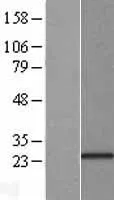 KCNIP1 (NM 014592) Humane overexpressie Lysaat