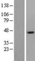 IL20 Receptor alfa (IL20RA) (NM 014432) Humane Overexpressie Lysaat