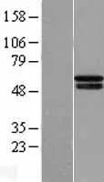 PHD4 (P4HTM) (NM 177939) Humane overexpressie Lysaat