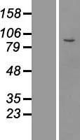 MPP8 (MPHOSPH8) (NM 017520) Humane overexpressie Lysaat