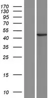 Aprataxine (APTX) (NM 175073) Humane overexpressie Lysaat