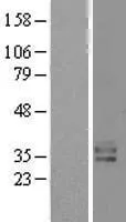 Kallikrein 15 (KLK15) (NM 138563) Menselijk overexpressie-Lysaat