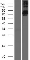 TSNAXIP1 (NM 018430) Humane overexpressie Lysaat