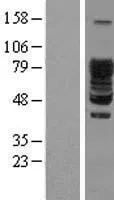 SCY1 als 3 (SCYL3) (NM 020423) Menselijke overexpressie Lysaat
