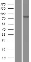 Acetoacetyl CoA synthetase (ACCS) (NM 023928) Human Over-expression Lysaat