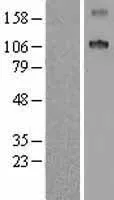 SCUBE1 (NM 173050) Humane overexpressie Lysaat