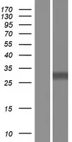 Transmembrane Proteïne 101 (TMEM101) (NM 032376) Humaan Over-expressie Lysaat