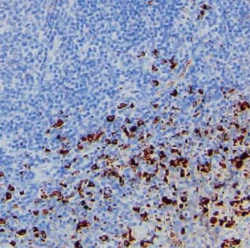 Anti-Human Lambda Antibody - image 1