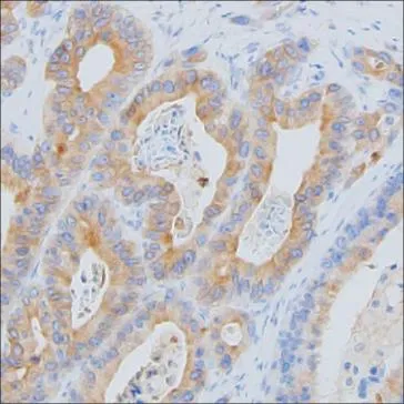 CCL2 Antibody - image 1