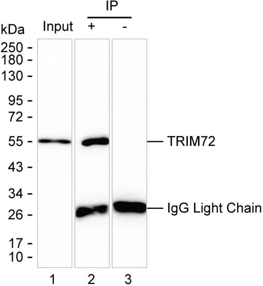 TRIM72 Antibody - image 1