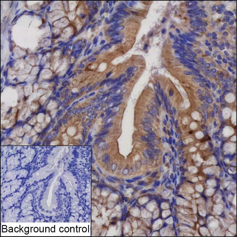 Krt18 Antibody - image 1