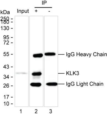 Prostate Specific Antigen Antibody - image 1