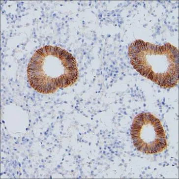 CMTM6 Antibody - image 1