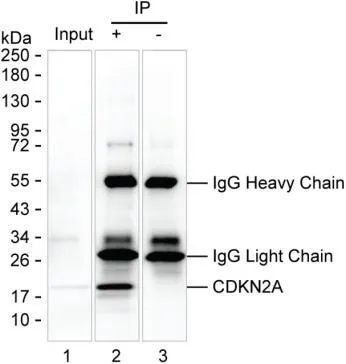 CDKN2A Antibody - image 1