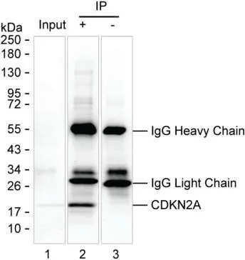 CDKN2A Antibody - image 1