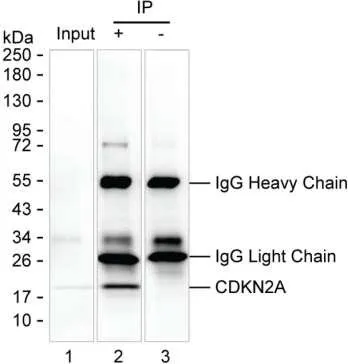 CDKN2A Antibody - image 1