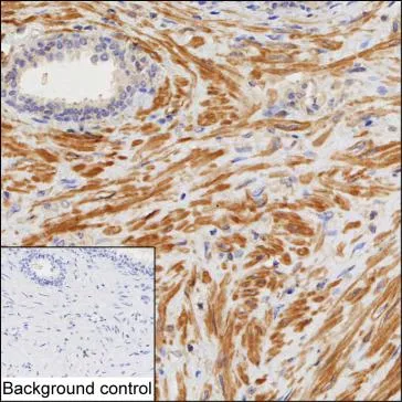 ACTG2 Antibody - image 1