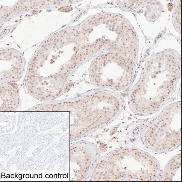 BUB1 Antibody - image 1