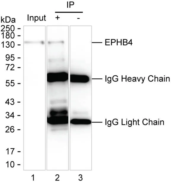 EPHB4 Antibody - image 1