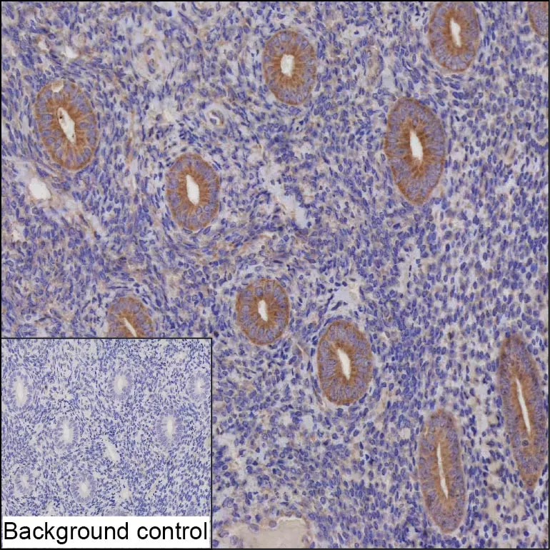 CAPN7 Antibody - image 1
