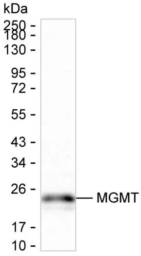 MGMT Antibody - image 1