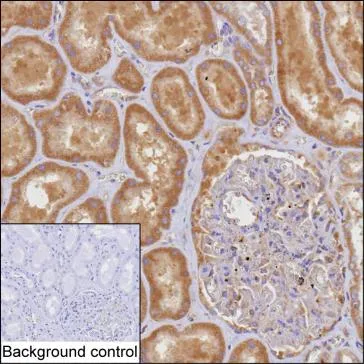 TACO1 Antibody - image 1