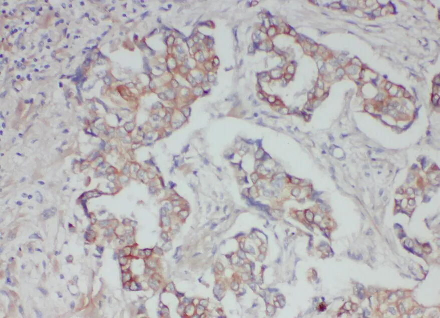 ABCB6 Antibody