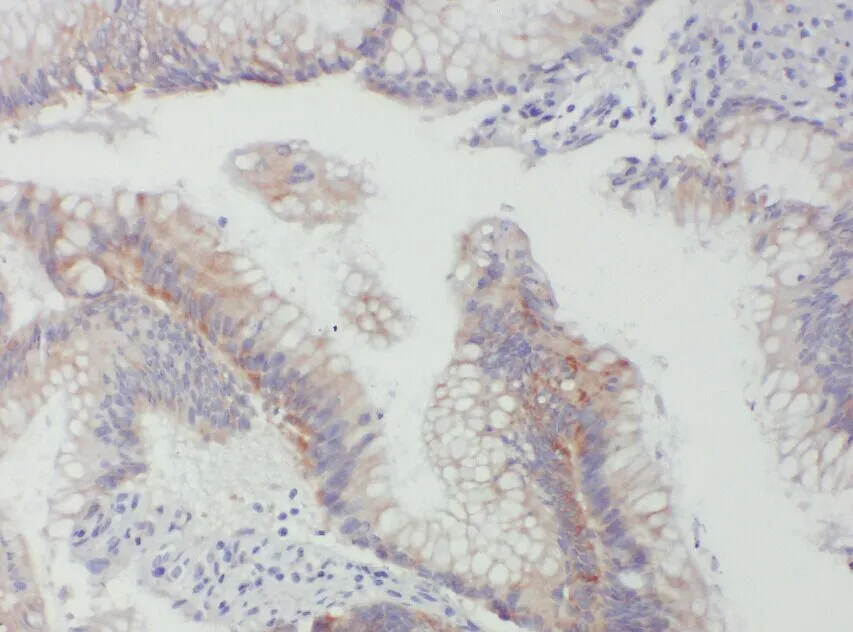 ACADL-Specific antibody - image 1