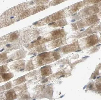 ACACA antibody - image 1