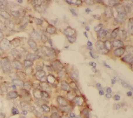 Acetylated tubulin (Lys40) antibody - image 1