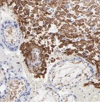 ACSL4 antibody - image 1
