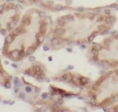 ACSM3 antibody - image 1