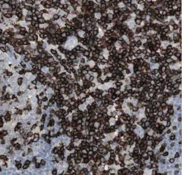 AGFG2 antibody - image 1