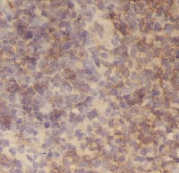 AGGF1 antibody - image 1