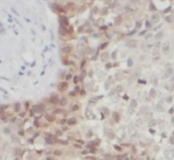 AKT1 antibody - image 1