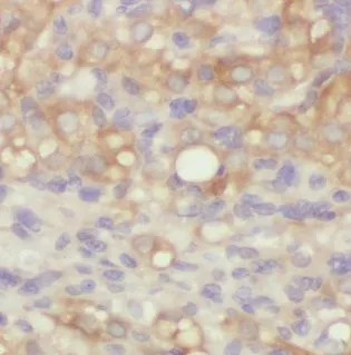 ADD1 antibody - image 1
