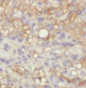 ARHGAP21 antibody - image 1
