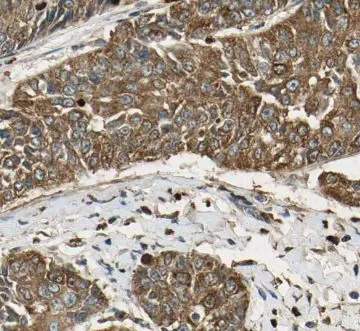 ATF6 antibody - image 1