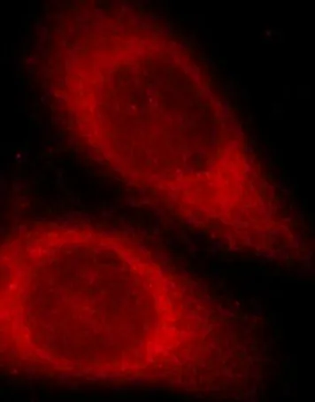 ATF6 antibody - image 2