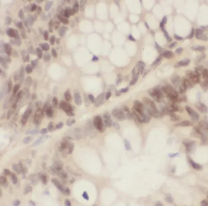 NPM1 antibody - image 1