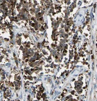 BACH1 antibody - image 1