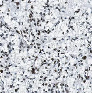 BCKDHB antibody - image 1