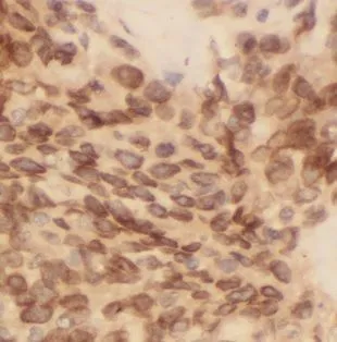 BCL10 antibody - image 1