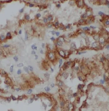 BPHL antibody - image 1