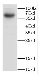 CACNB4 antibody - image 1