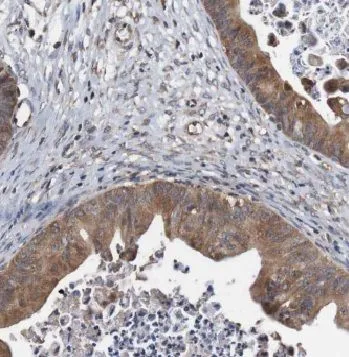 CALCOCO2 antibody - image 1