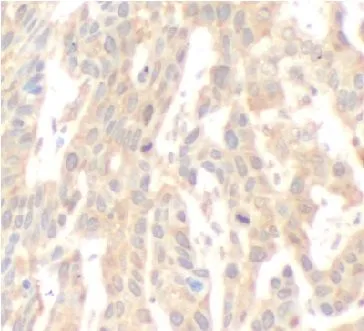 CAMKK2 antibody - image 1