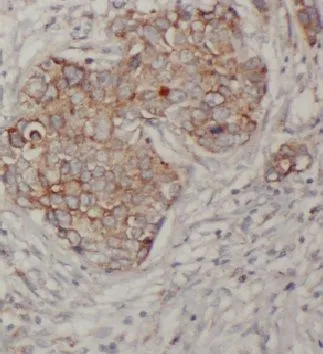 CTSD antibody - image 1