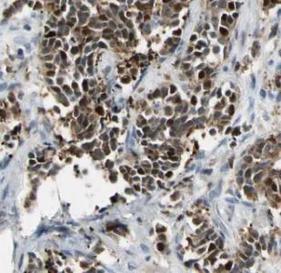 CDK2 antibody - image 1